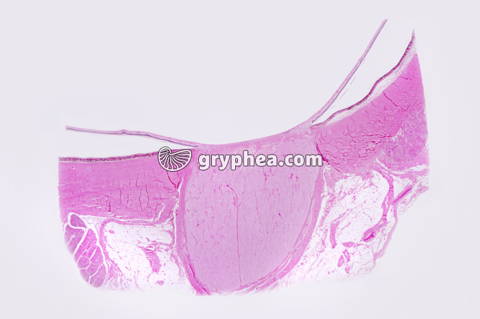 Tache aveugle Nerf optique x1,5 - gryphea.org